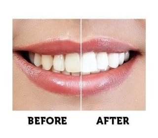 Tori + Mika Activated Charcoal Teeth Whitening Black Powder Toothpaste Best Natural 100% Organic White Teeth Whitener Bleach Carbon Fluoride Free Products Kit Cleaner Bright Wow Smile Bamboo No More Dental Strips