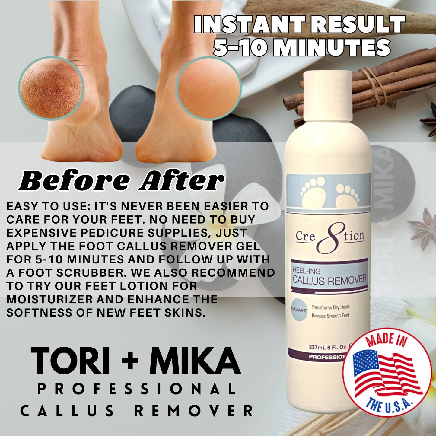 Tori Mika Cre8tion Professional Callus Remover for Feet and Feet Lotion Bundle, Powerful Formulation - Extra Strength Gel, Home Pedicure Foot Spa Results - Cracked & Dead Dry Skin Supplies Soft Feet